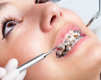 ارتودنسی پیشگیری (Interceptive Orthodontics)
